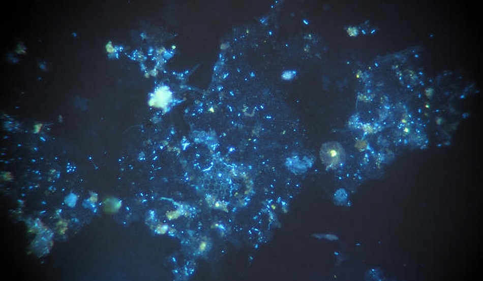 Фитопланктон в океане. Фитопланктон. Океанические бактерии. Фитопланктон под микроскопом. Фитопланктон картинки.