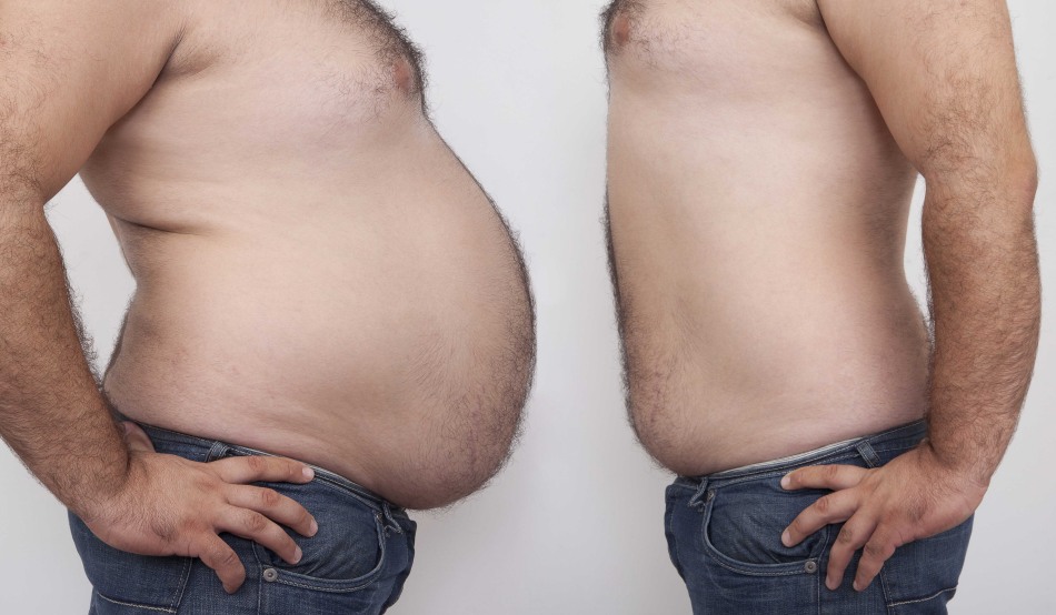 Tabere de pierdere în greutate pentru adulți obezi