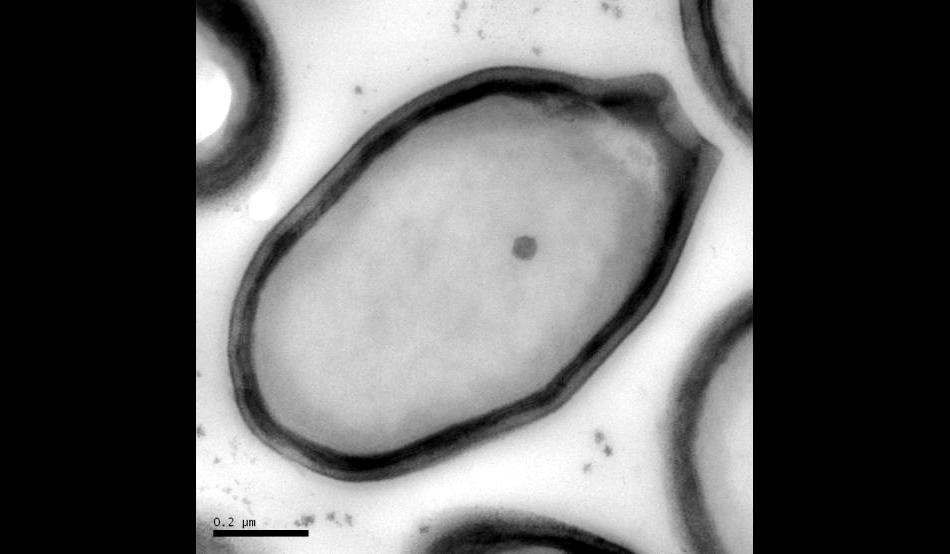 Pandoravirus - entitatea care ar putea schimba definiţia vieţii