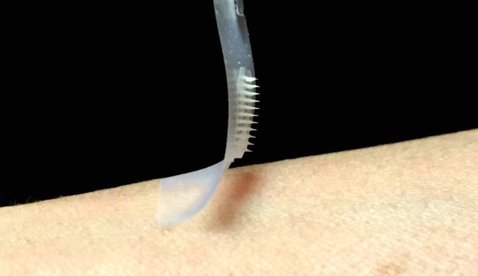 Oamenii de ştiinţă au creat un plasture nedureros care controla diabetul fără injecţii - FOTO+VIDEO