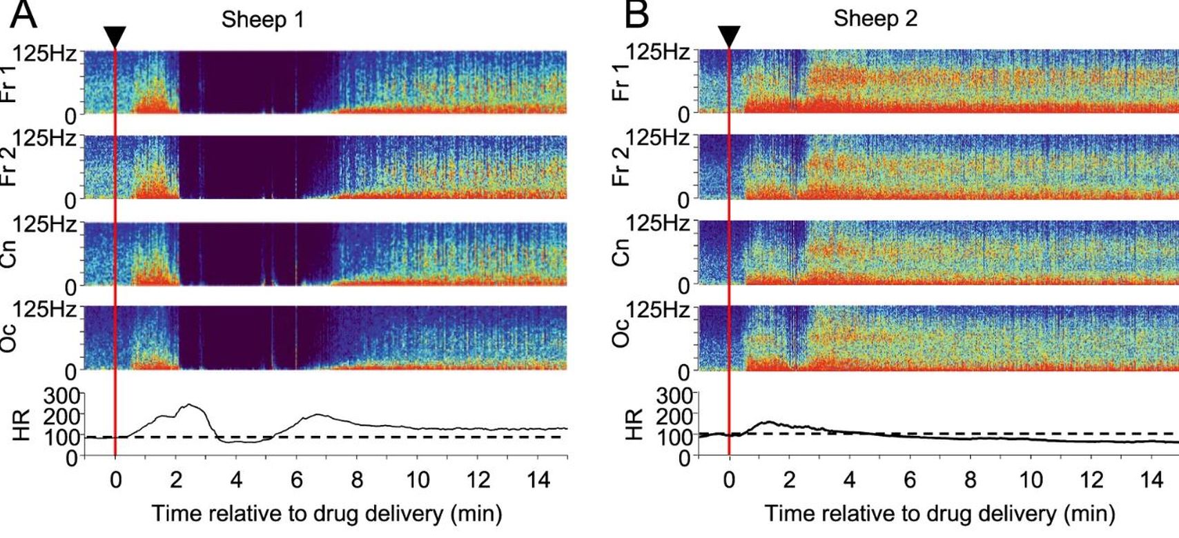 Un experiment cu ketamină a dezvăluit un fenomen pe care oamenii de știință nu l-au mai văzut până acum