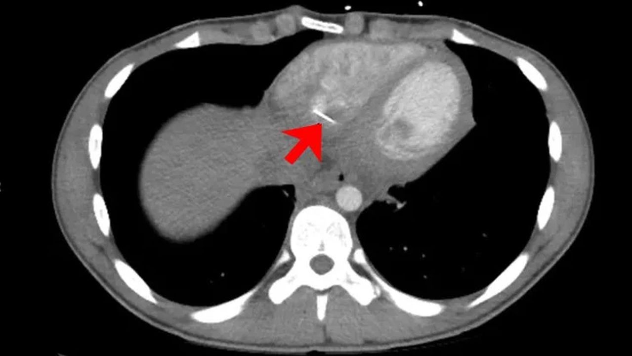 Может ли иголка дойти до сердца. Может ли иголка дойти до сердца. Сообщение об иголке и нитке. Вышивка иголкой и ниткой. Может ли иголка дойти до сердца.