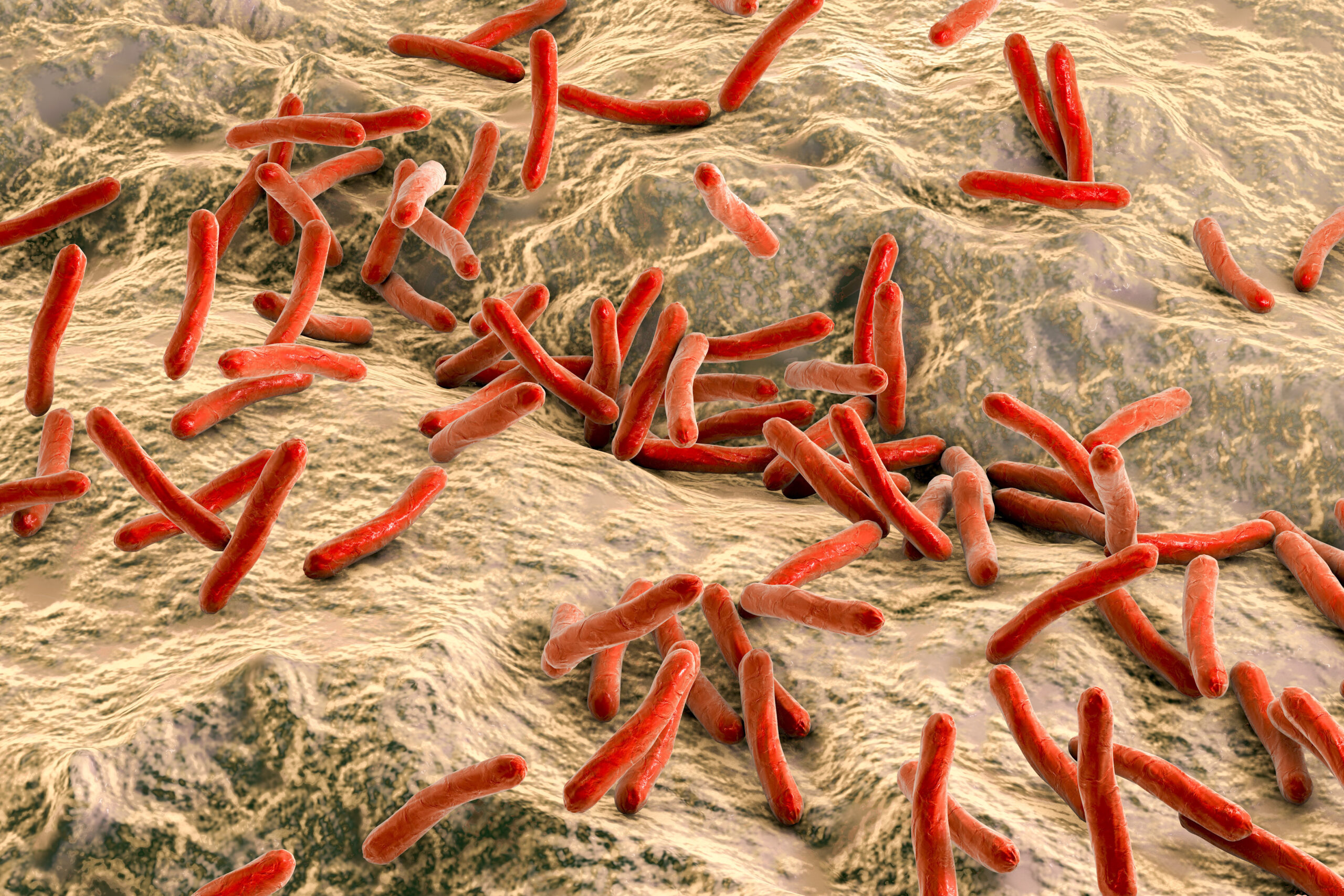 Заболевание туберкулез вызывают бактерии. Микобактерия Гансена—Нейссера. Микобактериум туберкулёзис.
