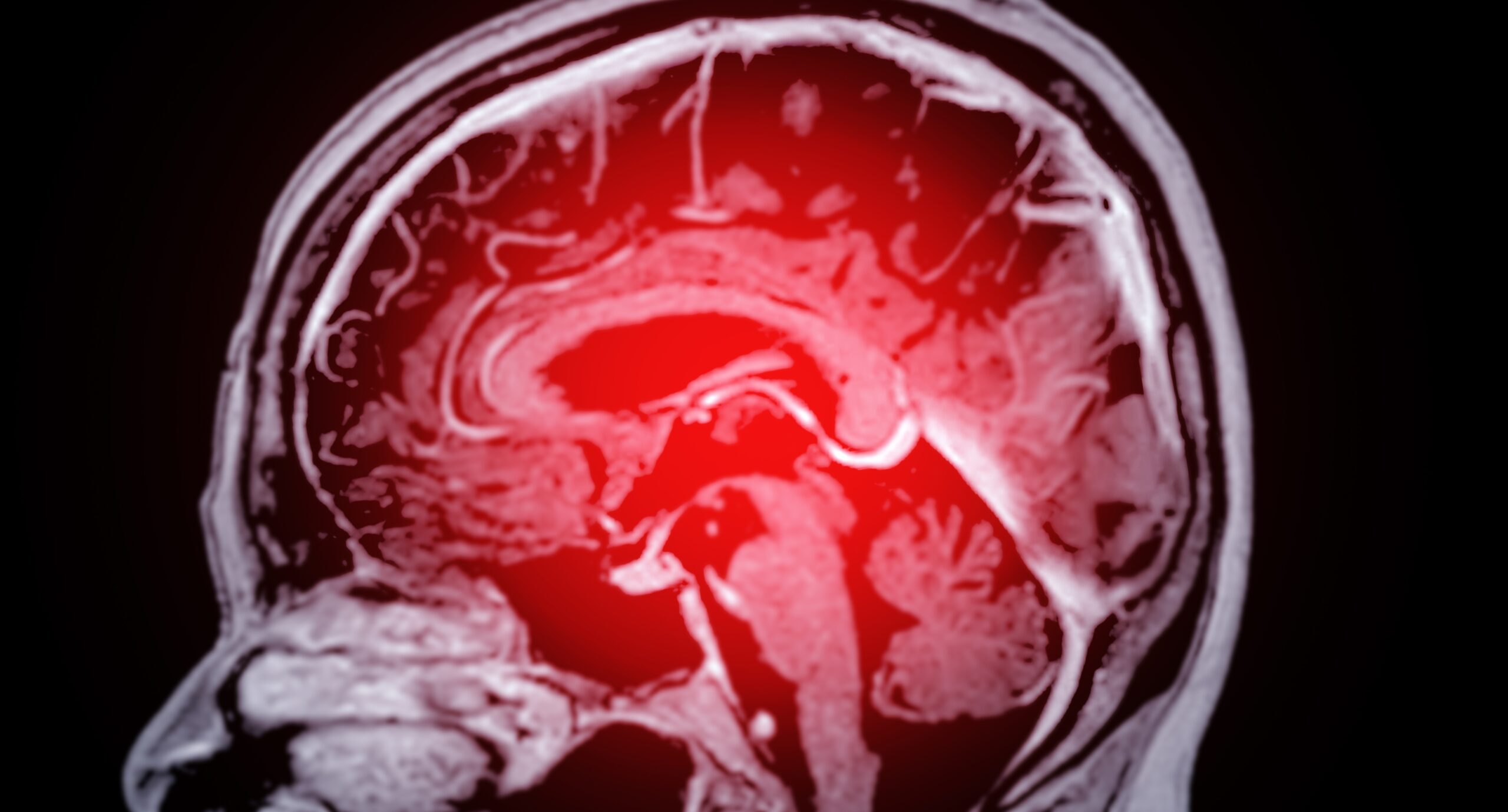 Microbiomul creierului ar putea ajuta la prevenirea demenței?