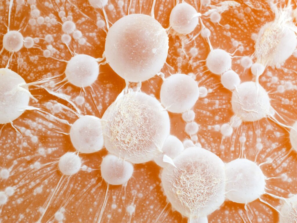 Două gene-cheie ar putea bloca metastazele în cancerul colorectal