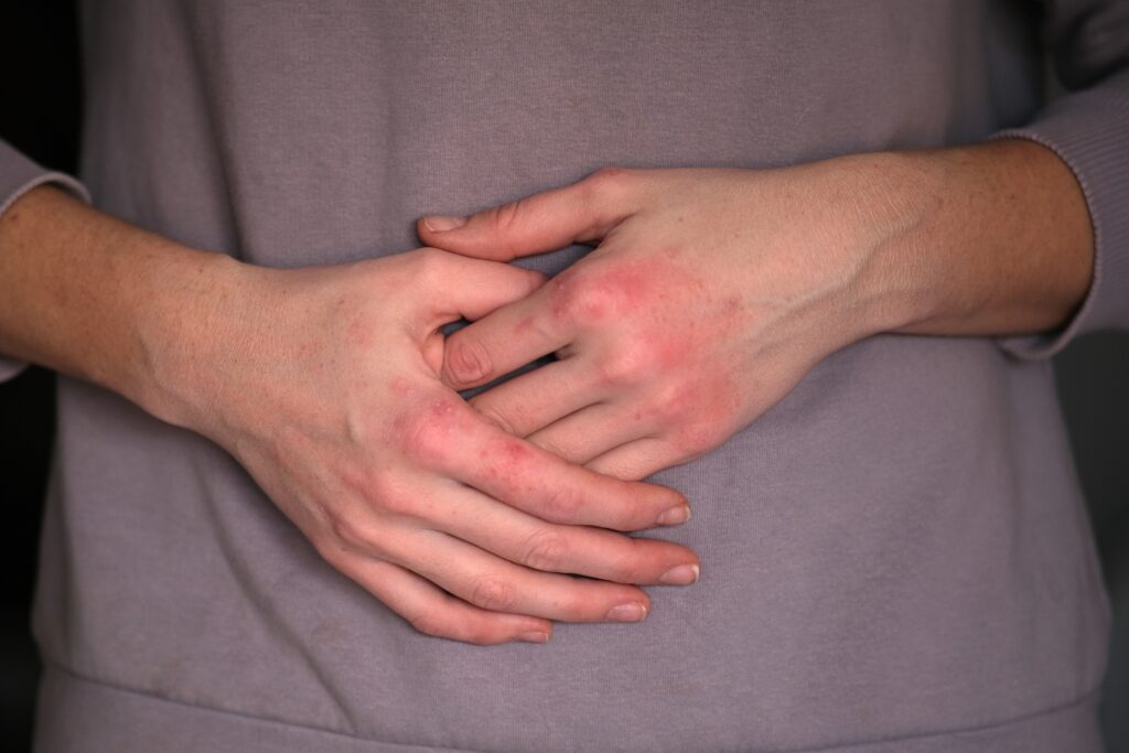 Inflamația din organism ar putea influența sănătatea mintală?