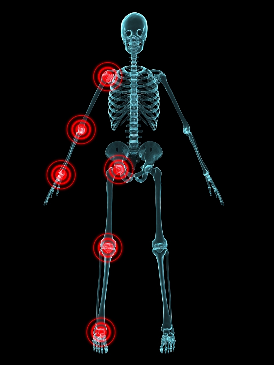 Inflamaţia: focul din corp care ne poate ucide