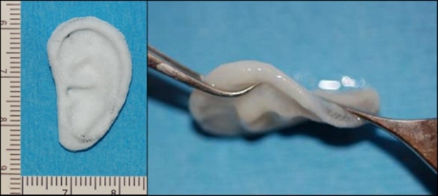 Piese de schimb pentru corpul uman: urechi „crescute” în laborator