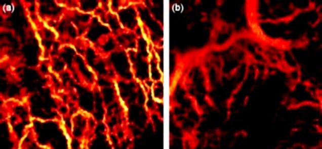 Aparatul care „vede sub piele” îi va ajuta pe medici să diagnosticheze diferite boli, inclusiv cancere