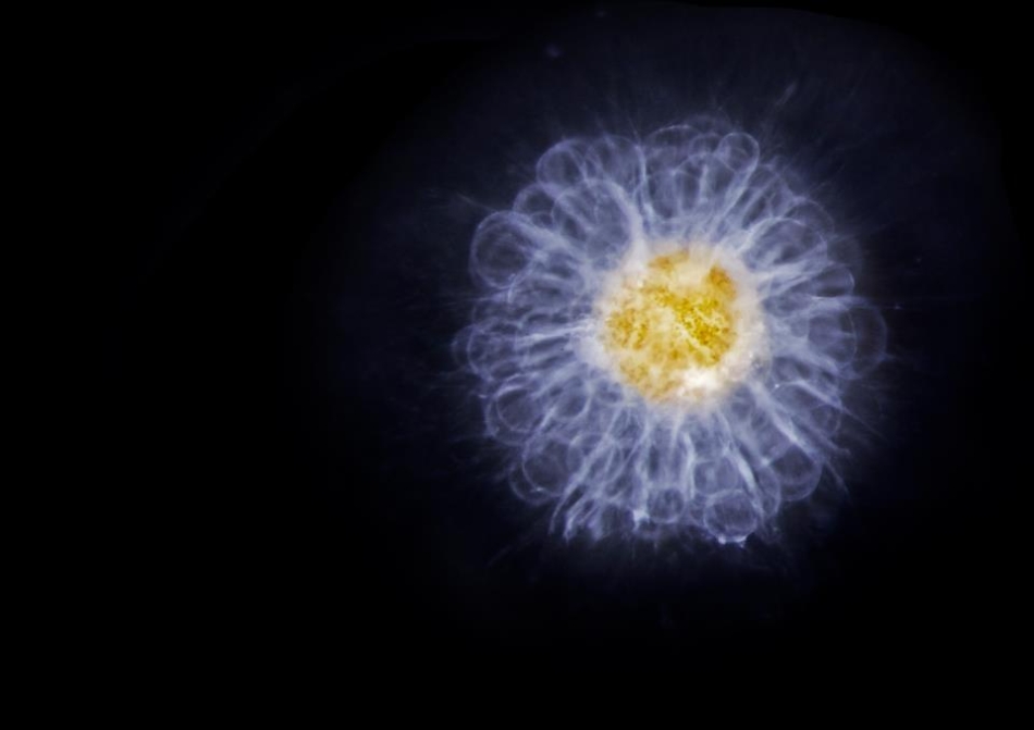 Radiolarian - Mediterranean / Foto: Franck Preijger - CNRS - Tara Oceans - 2009