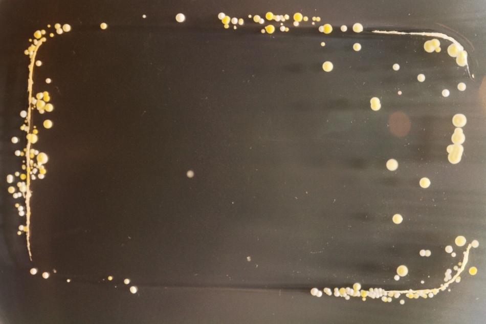 Bacteriile găsite pe telefoanele mobile/ Foto credit: Simon Park, Univeristatea Surrey