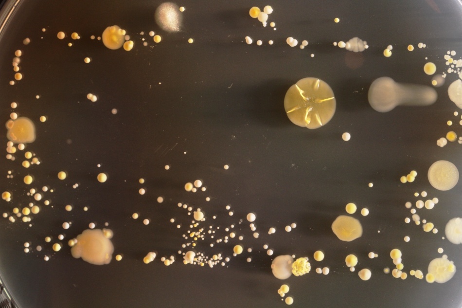 Bacteriile găsite pe telefoanele mobile/ Foto credit: Simon Park, Univeristatea Surrey