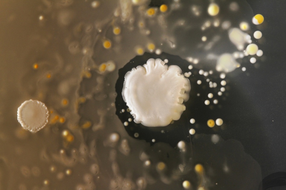 Bacteriile găsite pe telefoanele mobile/ Foto credit: Simon Park, Univeristatea Surrey