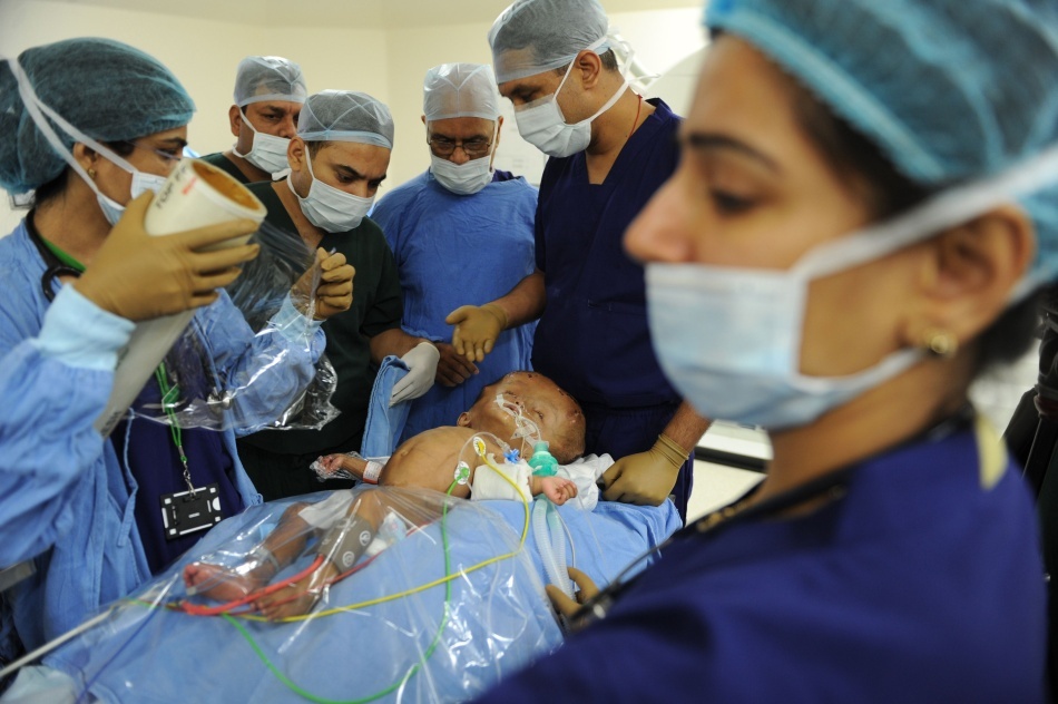 Intervenţie medicală de succes: fetiţa cu cap gigantic a fost operată