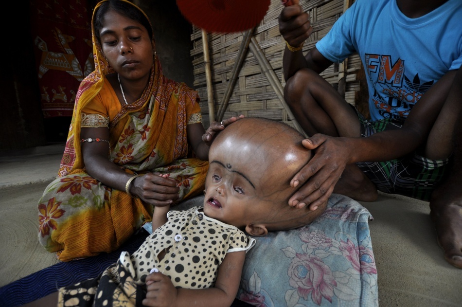 Roona şi părinţii, înainte de intervenţia medicală