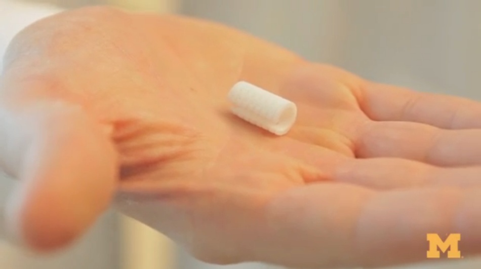 Imprimantele 3D salvează vieţi: un bebeluş a supravieţuit mulţumită unui dispozitiv medicat printat 3D