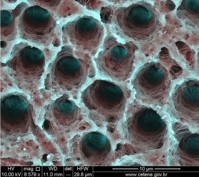 Dentina unui dinte, fotografiată în detaliu