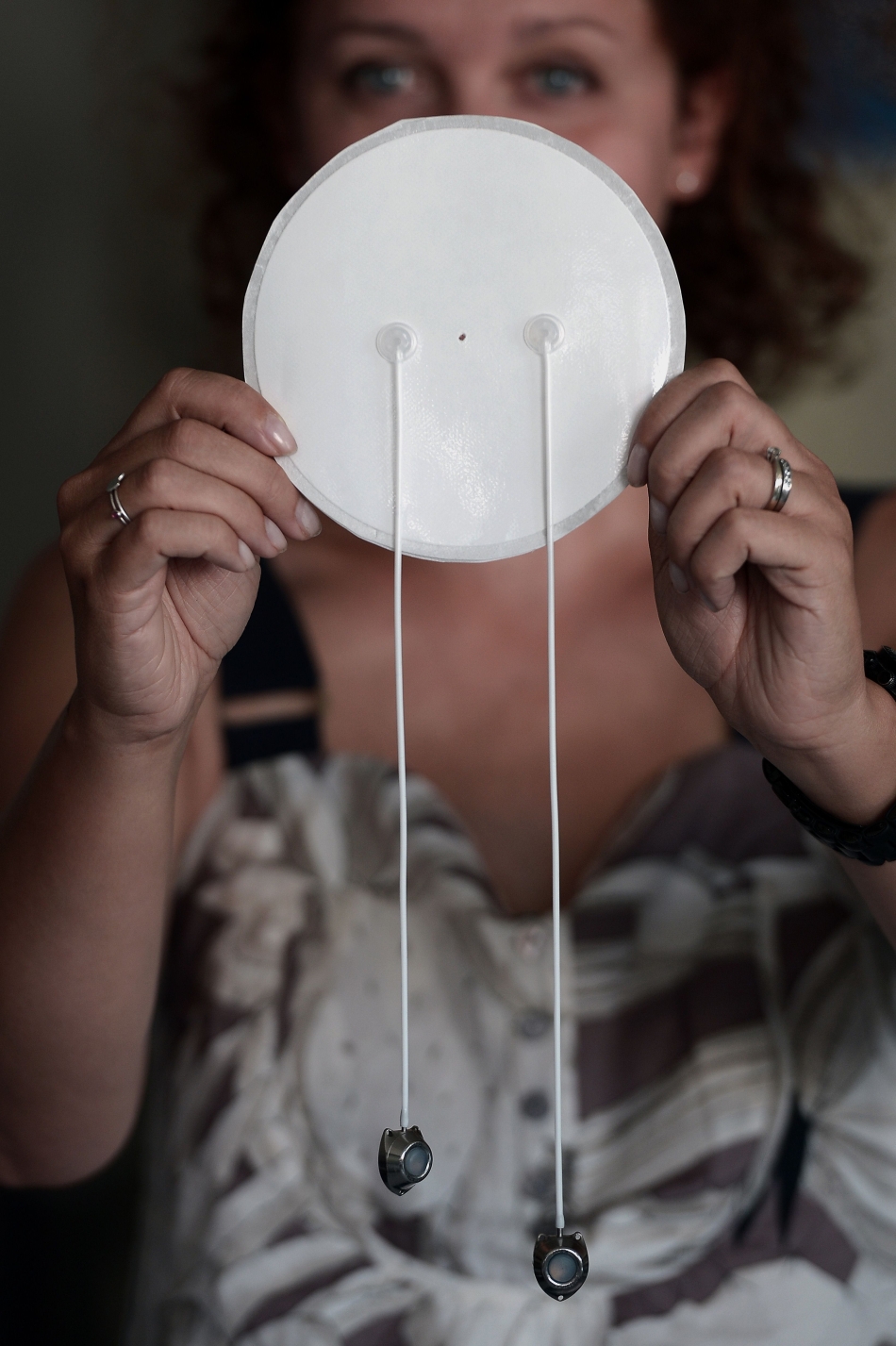 Discul din polimeri va fi implantat în abdomen, în timpul unei scurte intervenţii chirurgicale, şi trebuie să fie înlocuit la fiecare 4-6 ani. 