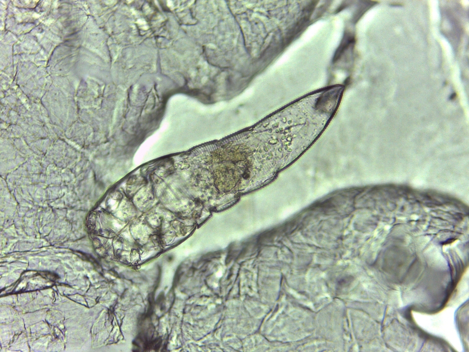 Demodex brevis