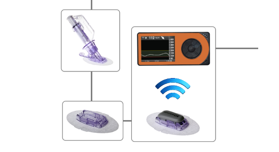 Informaţiile despre nivelurile de glicemie sunt transmise către o aplicaţie de pe smartphone, care ia decizii la fiecare cinci minute şi indică apoi pompei, prin Bluetooth, cantitatea de insulină şi de glucagon care trebuie furnizată.