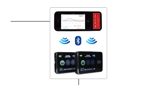 Informaţiile despre nivelurile de glicemie sunt transmise către o aplicaţie de pe smartphone, care ia decizii la fiecare cinci minute şi indică apoi pompei, prin Bluetooth, cantitatea de insulină şi de glucagon care trebuie furnizată.