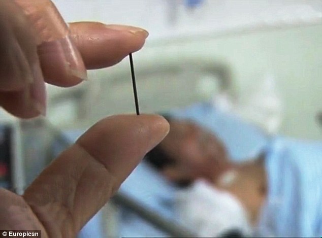 Acul scos din corpul lui Xu Long