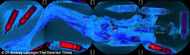 Mumia analizată la RMN