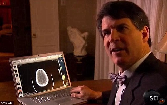 Medicul Eben Alexander