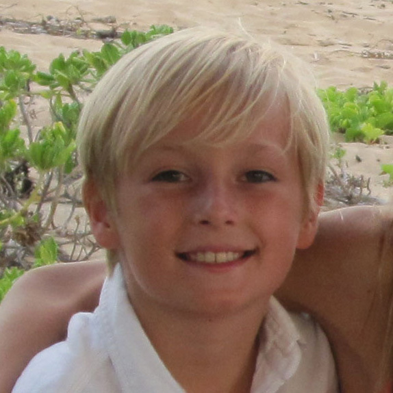 Jackson Small suferea de o formă de epilepsie care nu a reacţionat la tratamentele obişnuite