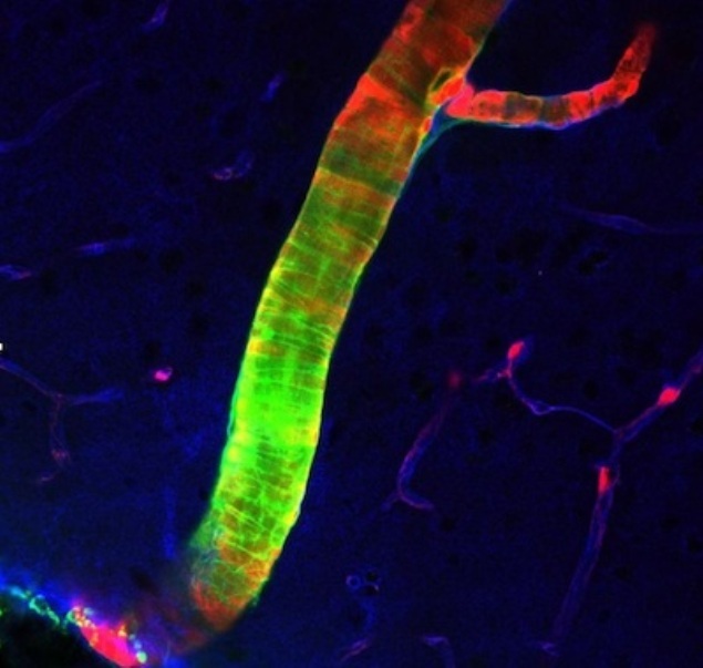 Cum se curăţă creierul ? (VIDEO)