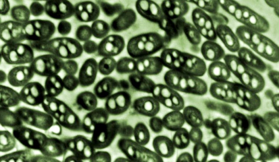 Bacteria Ralstonia eutropha