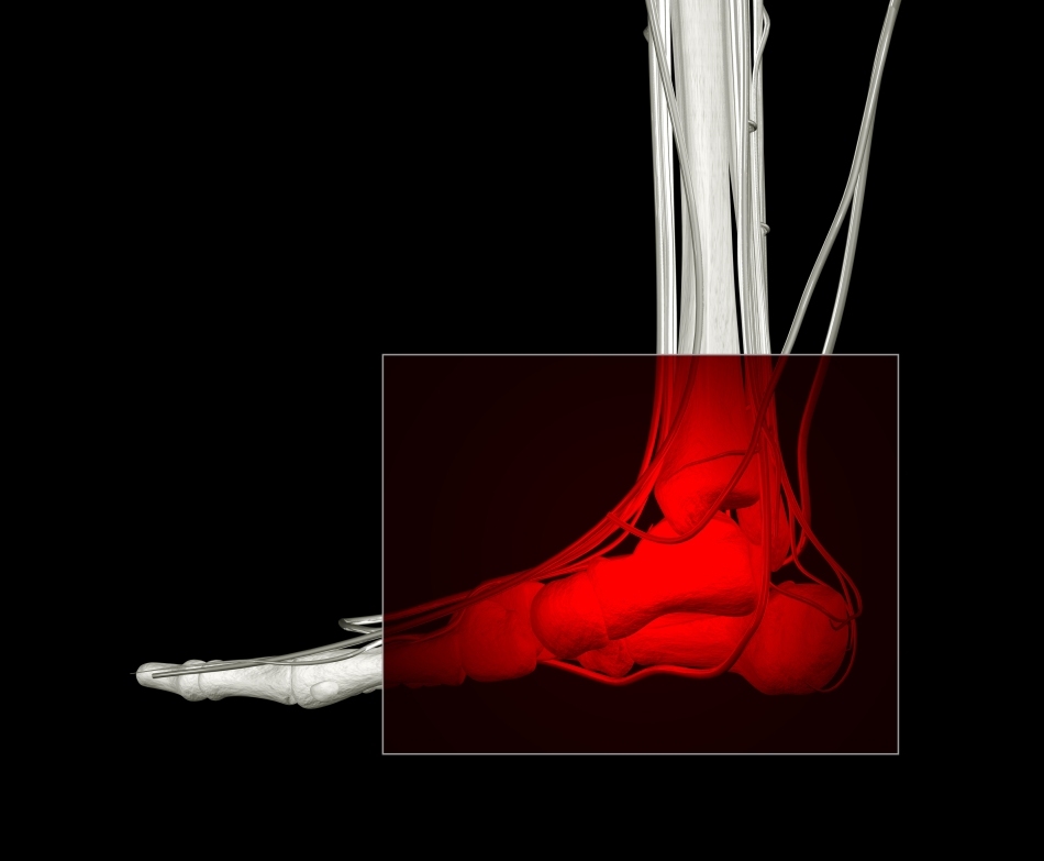 Şi strămoşii omului aveau probleme la nivelul gleznelor, din cauza solicitărilor mari la nivelul acestor articulaţii.