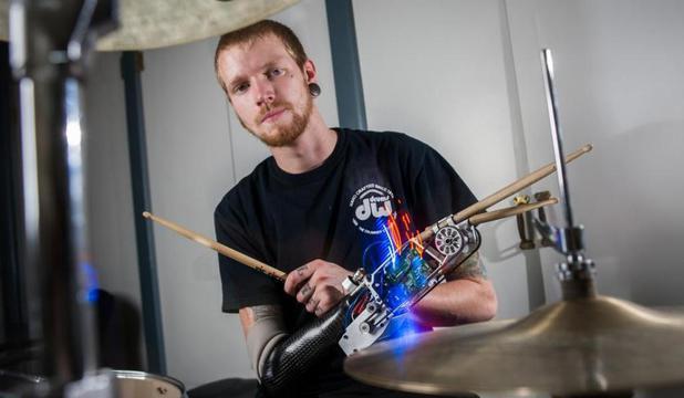 Bateristul Jason Barnes, care şi-a pierdut un braţ într-un accident, are acum o proteză performantă, care îl ajută să cânte mult mai bine.