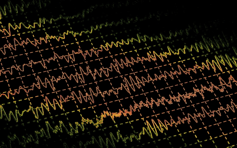 Electroencefalograma (EEG) este utilizată azi pe scară largă pentru confirmarea diagnosticului de epilepsie. 