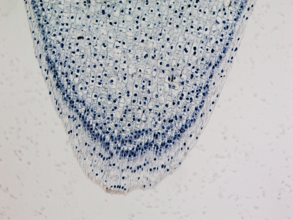 Celulele diferitor organisme privite sub microscop şi microfotografiile uimitoare ale acestora. 