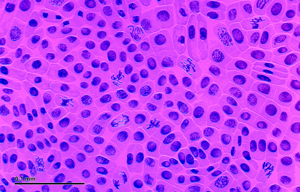 Celulele diferitor organisme privite sub microscop şi microfotografiile uimitoare ale acestora. 